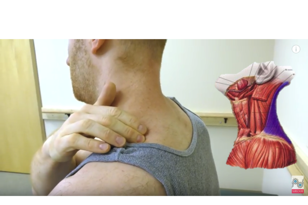 upper-trapezius-pain-physical-therapy-101